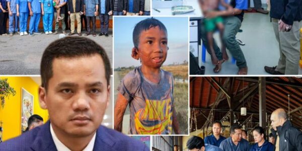 អបអរសាទរ! ក្រោមការជួយជ្រោមជ្រែងពី ឯកឧត្តម ស សុខា ក្មេងប្រុសរងគ្រោះដោយភ្លើងឆេះ នឹងទទួលបានការវះកាត់នៅដើមខែក្រោយ
