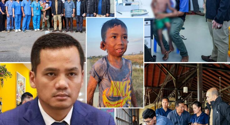 អបអរសាទរ! ក្រោមការជួយជ្រោមជ្រែងពី ឯកឧត្តម ស សុខា ក្មេងប្រុសរងគ្រោះដោយភ្លើងឆេះ នឹងទទួលបានការវះកាត់នៅដើមខែក្រោយ