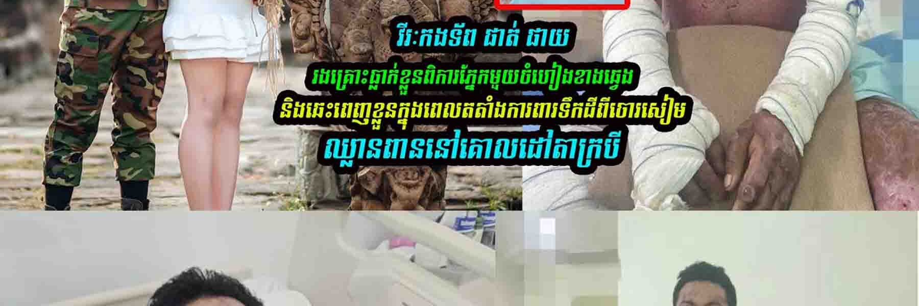 អាសូរណាស់!  វីរៈកងទ័ព ផាត់ ផាយរងគ្រោះពិការភ្នែកមួយចំហៀងខាងឆ្វេង…..