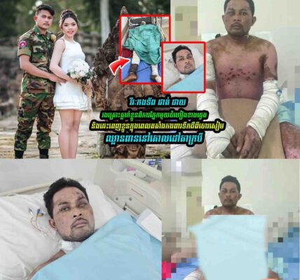 អាសូរណាស់!  វីរៈកងទ័ព ផាត់ ផាយរងគ្រោះពិការភ្នែកមួយចំហៀងខាងឆ្វេង…..