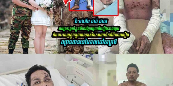 អាសូរណាស់!  វីរៈកងទ័ព ផាត់ ផាយរងគ្រោះពិការភ្នែកមួយចំហៀងខាងឆ្វេង…..